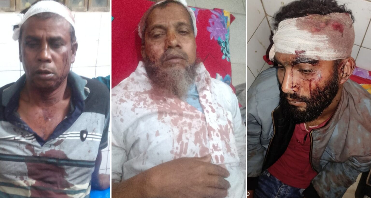 বাঘারপাড়ায় বিএনপি-জামায়াতের সংঘর্ষ, আহত ৩