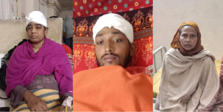 চৌগাছায় ইউপি সদস্য দা’র আঘাতে আহত-৩