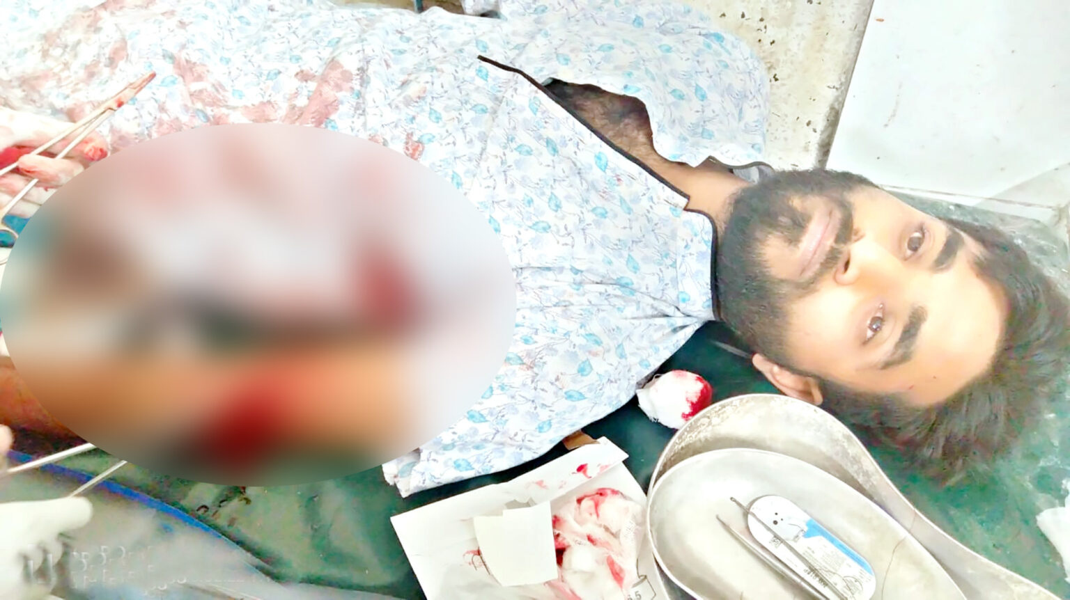 অভয়নগরে হত্যার উদ্দেশ্যে অতর্কিত হামলা অতঃপর থানায় অভিযোগ