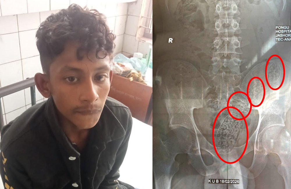 যশোরে যুবকের পেটে মিলল ইয়াবা