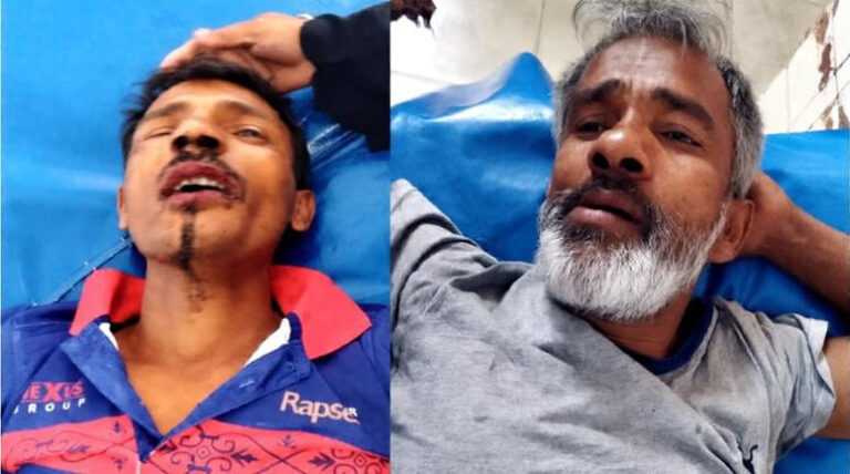 যশোরে যুবলীগ নেতা বাবুকে কুপিয়ে জখম