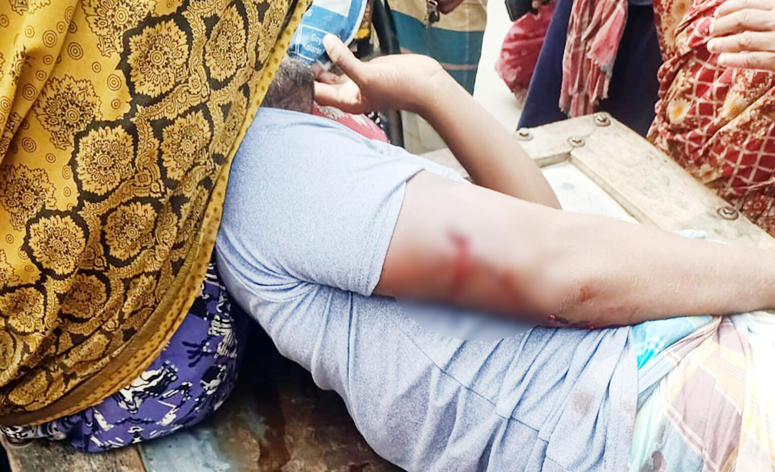 শার্শায় চাঁদার দাবিতে যুবককে হাতুড়িপেটা