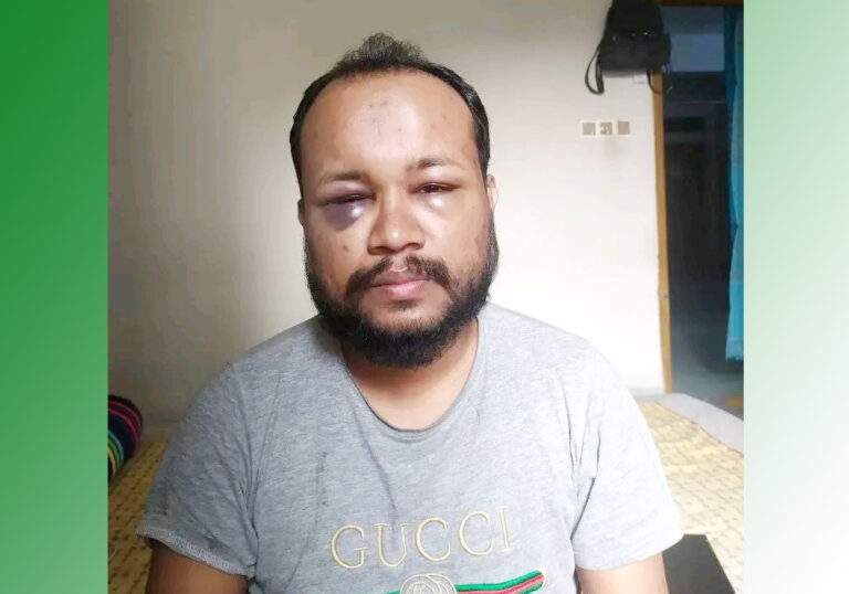 মাথায় গুলিবিদ্ধ ‘জুলাই যোদ্ধা’ এনাম অর্থাভাবে থমকে চিকিৎসা, দিশেহারা পরিবার