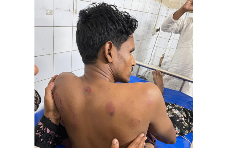 বেনাপোলে বাংলাটিভির সাংবাদিকের ওপর হামলা