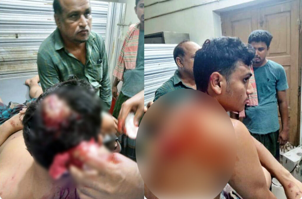 কেশবপুরে মাছ লুট ঘটনায় মারপিটে রক্তাক্ত জখম যুবক