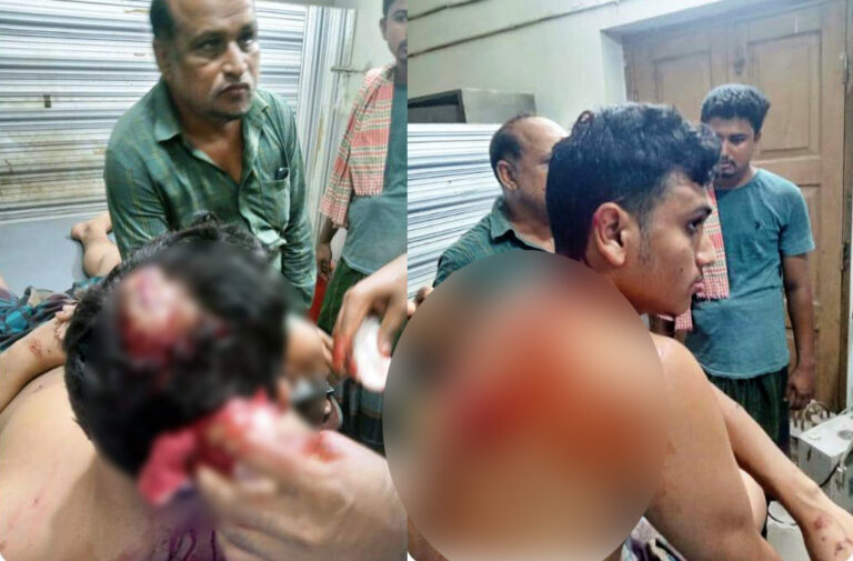 কেশবপুরে মাছ লুট ঘটনায় মারপিটে রক্তাক্ত জখম যুবক কেশবপুরে মাছ লুট ঘটনায় মারপিটে রক্তাক্ত জখম যুবক