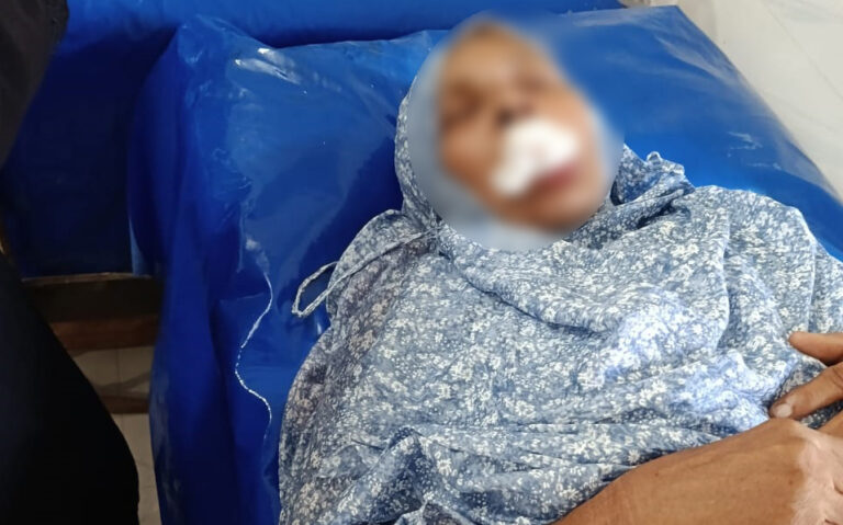 শ্যামনগরে ছেলের লাথিতে গেল মায়ের দাঁত